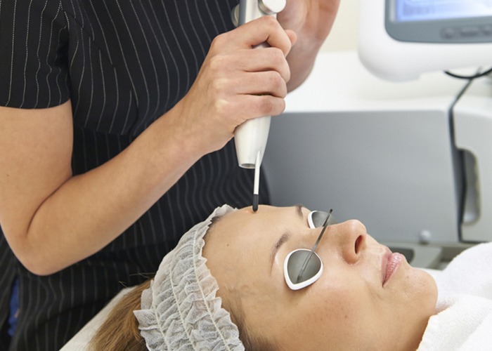 q switch laser treatment in Delhi